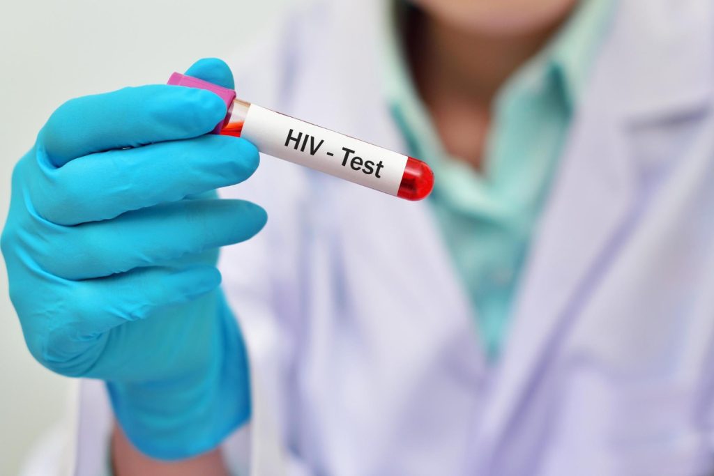 HIV Testing